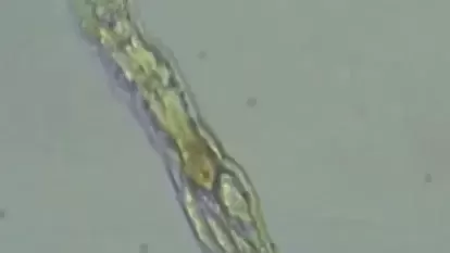 Ancient Herpesviruses Found in 2,000-Year-Old Remains